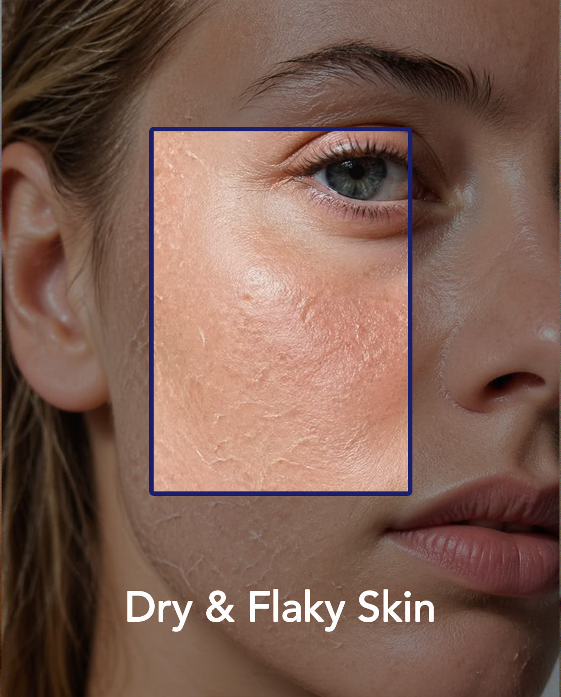 Dry & Flaky skin