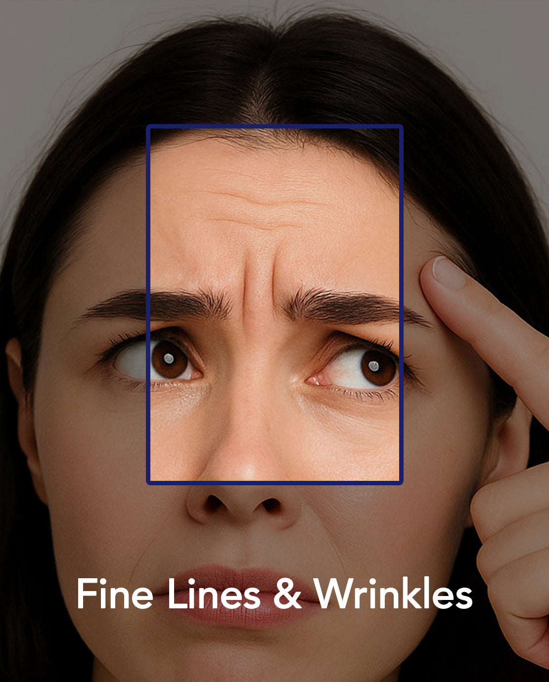 Fine lines & wrinkles